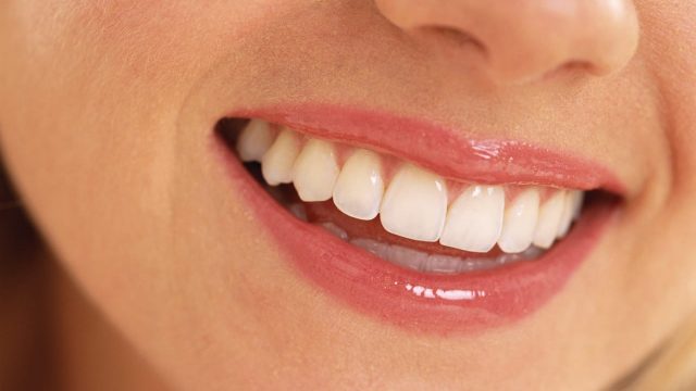 كيف تحصلين على أسنان بيضاء كاللؤلؤ في وقت قياسي؟