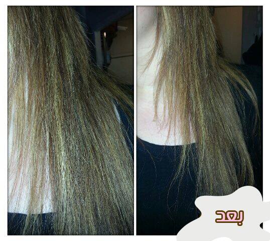 طرق العناية بالشعر الجاف