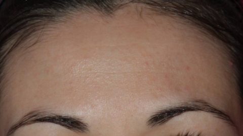 طرق فعالة لإعلان الحرب على المسامات المسدودة