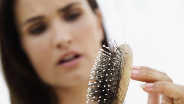 تساقط الشعر 2: العلاج