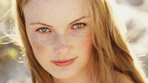 3 طرق بسيطة حتى تتخلصي من النمش