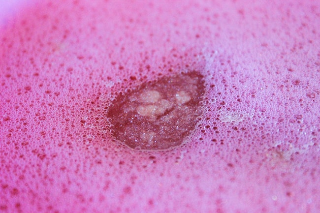 إزالة الرؤوس السوداء