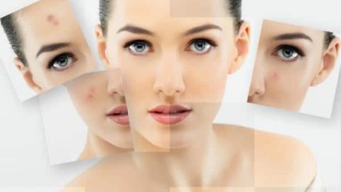 جربي وصفات الملح الانجليزي للقضاء على حبوب الوجه