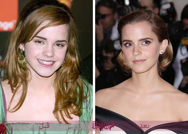 إيما واتسون