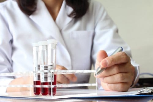 علاج فقر الدم 