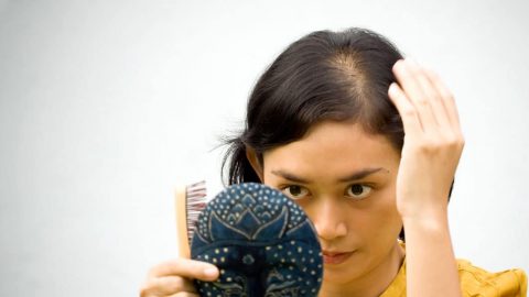 5 وصفات طبيعية لعلاج الصلع