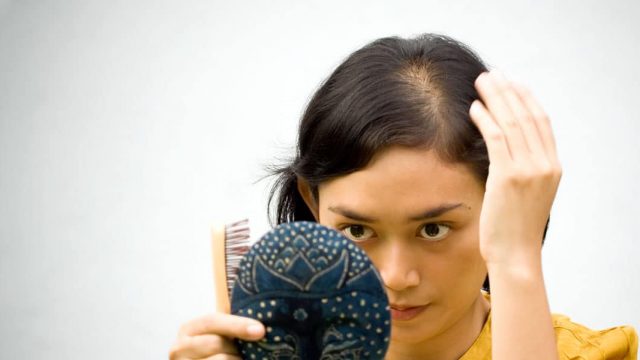 5 وصفات طبيعية لعلاج الصلع