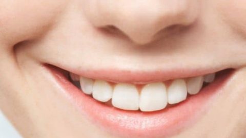 تخلصي من البقع الداكنة حول فمك عبر هذه الوصفة