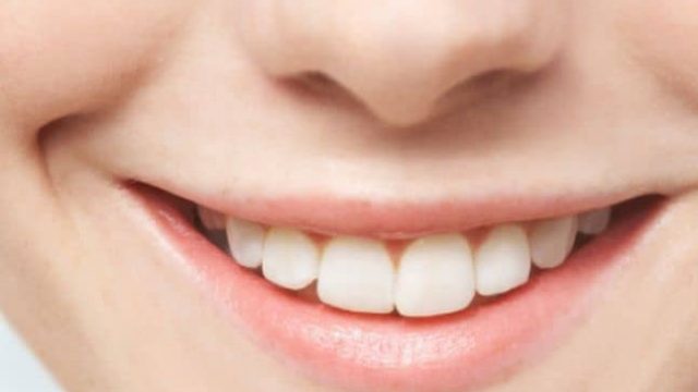 تخلصي من البقع الداكنة حول فمك عبر هذه الوصفة