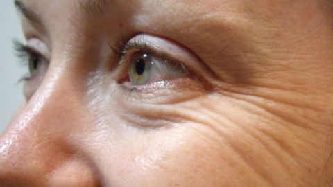 وصفات طبيعية لمكافحة التجاعيد