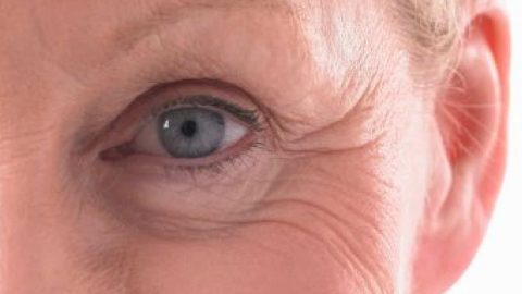 وصفات طبيعية للتخلص من التجاعيد