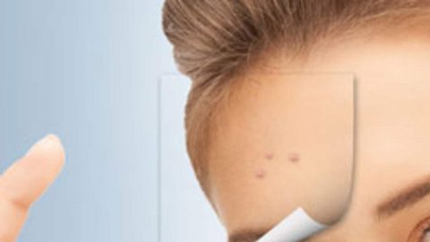 علاجات طبيعية للقضاء على البقع والرؤوس السوداء