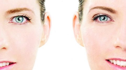 تغلبي على ترهلات الجفون من خلال هذه الوصفة الطبيعية