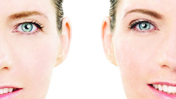 تغلبي على ترهلات الجفون من خلال هذه الوصفة الطبيعية