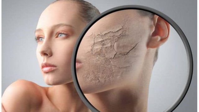 وصفة طبيعية لحماية البشرة من الجفاف