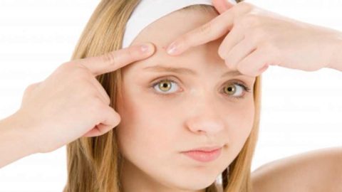 وصفة طبيعية للتخلص من حب الشباب