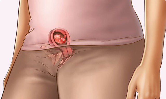 أعراض الحمل