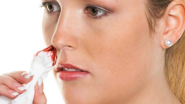 نزيف الأنف وطرق علاجه في المنزل