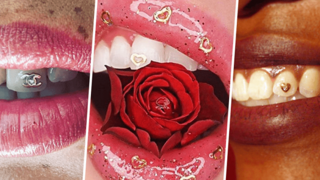 كريستال وقطع معدنية لتزيين الأسنان..هل تجرئين؟