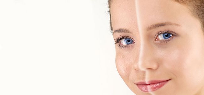 أفضل العلاجات الطبيعية التي تساعد على التخفيف من الندوب