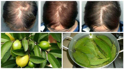 كيف تساعدك أوراق الجوافة في التخلص من مشكلة تساقط الشعر؟
