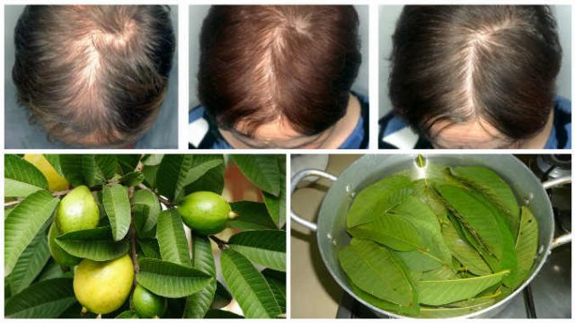 كيف تساعدك أوراق الجوافة في التخلص من مشكلة تساقط الشعر؟