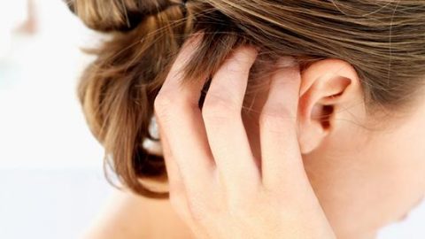 سيروم طبيعي للتخلص من القشرة نهائيًا