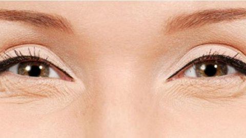 عادات تسبب تجاعيد العينين.. احذريها