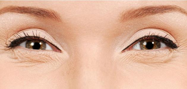 عادات تسبب تجاعيد العينين.. احذريها