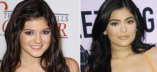 عمليات تجميل صادمة قامت بها نجمات عالميات.