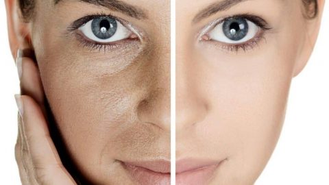 طبقي هذه الوصفة لتتخلصلي من الكلف والتصبغات نهائيًا