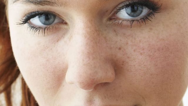 نصائح بسيطة لازالة البقع من البشرة