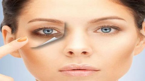 هذه العوامل تؤدي إلى بروز الهالات السوداء فاحذريها