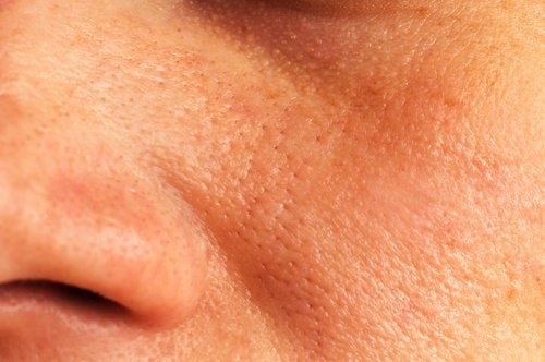 pores-agrandis-500x332-500x332
