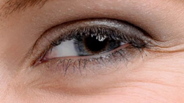 أفضل الوصفات للتخلص من التجاعيد حول العينين