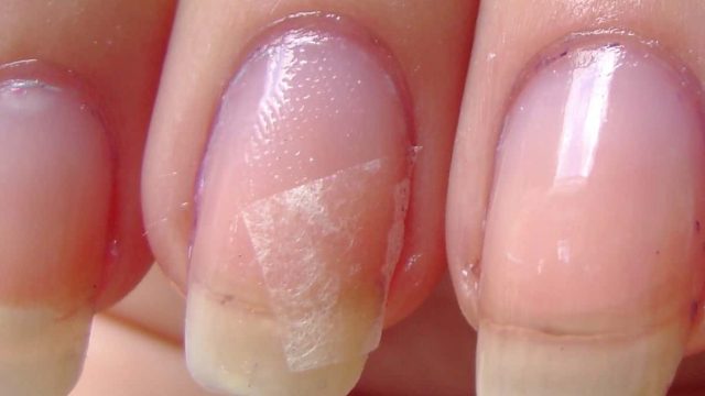 خطوات لإصلاح أظافرك المكسورة في دقائق