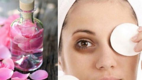 طرق استخدام ماء الورد لعلاج الهالات السوداء