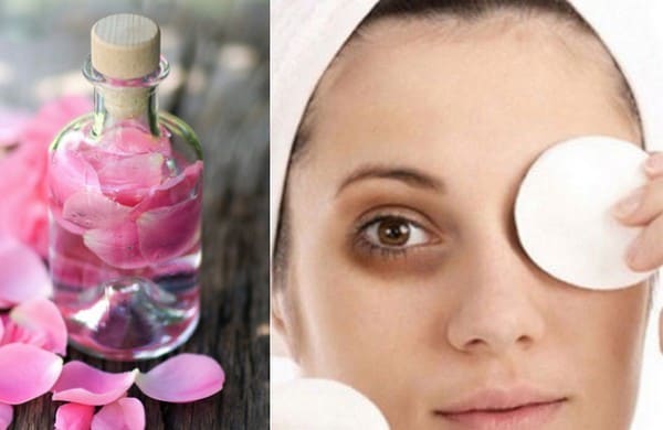 طرق استخدام ماء الورد لعلاج الهالات السوداء