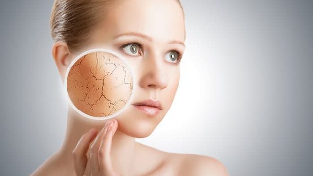 نصائح للتخلص من جفاف البشرة وتشققات الجلد في الصيف