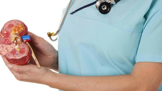 كيفية حماية الكلى من الحصى