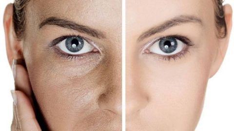 كيف نقوم بتضييق مسامات الوجه؟