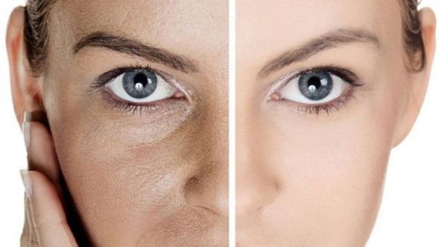 كيف نقوم بتضييق مسامات الوجه؟