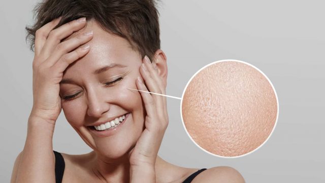 كيف أتعامل مع البشرة الدهنية؟