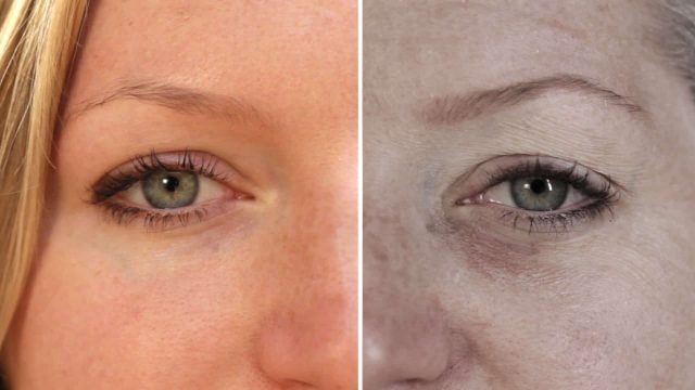 3 عادات يومية سيئة تسبب ظهور التجاعيد تحت العين