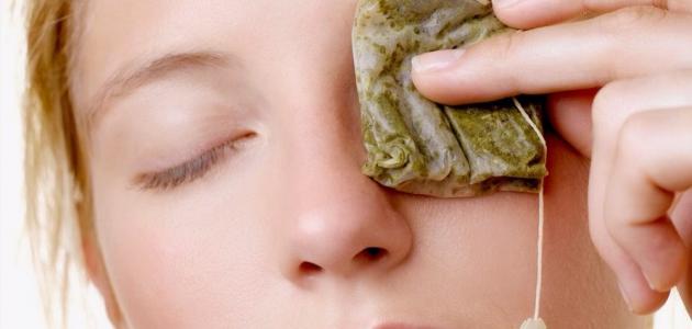 ثلاث طرق لتتخلصي من الهالات السوداء