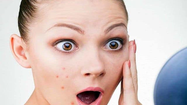 إليك هذه الوصفات المذهلة للتخلص من الرؤوس السوداء