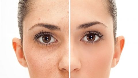 قناع الباذنجان لبشرة خالية من الندوب والبقع