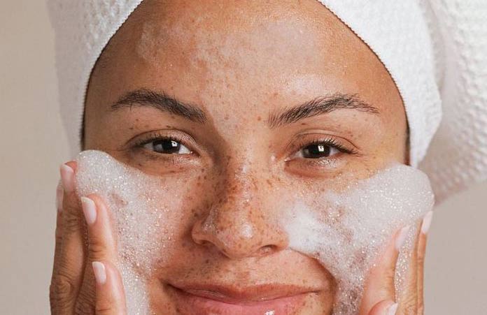 وصفات النمش