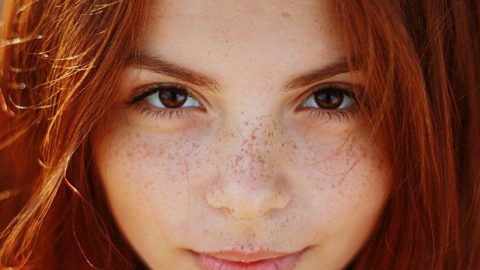 تخلصي من النمش بهذه الطرق الطبيعية