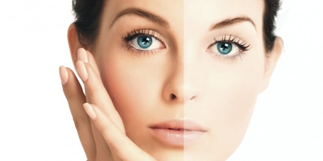 هكذا تقومين بتفتيح بشرتك الدهنية في فصل الصيف